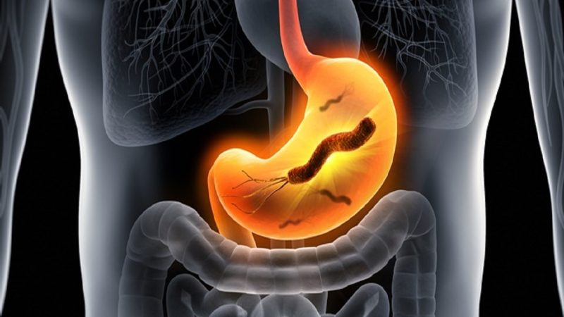 شکم درد یا درد شکم چیست؟