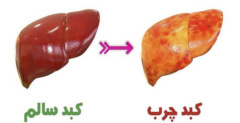 از نشانه های بیماری کبد، مشکلات پوستی است