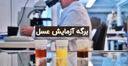 برگه آزمایش عسل